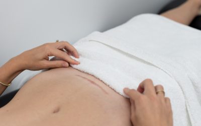 Why Scar Massage Matters After Cesarean Delivery